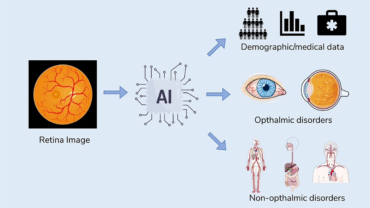 Figure 1. Overview of the applications of AI algorithms based on retinal photos.