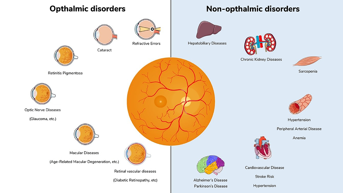 Figure 2. The application of retinal photo-based AI in both ophthalmic and non-ophthalmic conditions.